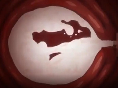 Thumbnail of post image 022